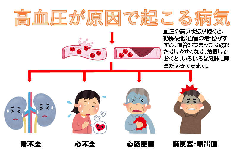 高血圧が原因で起こる病気